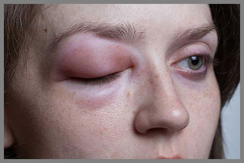 Allergy testing at Total Look Hair salon, Monmouth